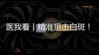 医我看丨精准狙击白斑！这款“港澳药械通”白癜风新药开出澳珠首方