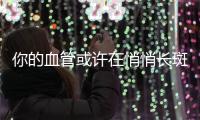 你的血管或许在悄悄长斑

！这样做�，“斑块”可能缩小→
