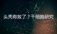 头秃有救了？干细胞研究阐明压力如何影响毛发生长